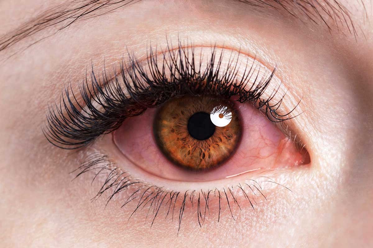 Rising Vision Problems in the Digital Age: The Hidden Damage Screens Are Causing to Your Eyes