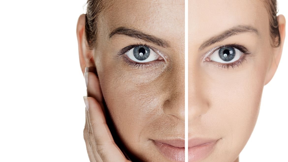 Early Wrinkles, Dullness & Loose Skin: A Silent Aging Problem
