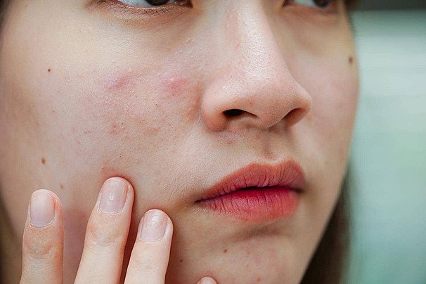 The Hidden Reason Your Skin Feels Irritated, Inflamed & Unbalanced
